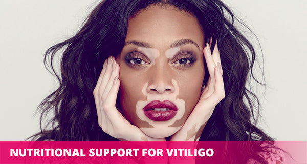 best supplements for vitiligo