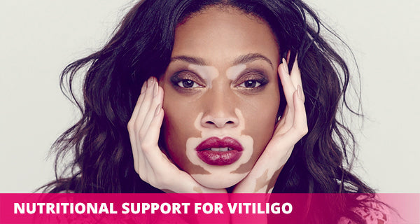 best supplements for vitiligo