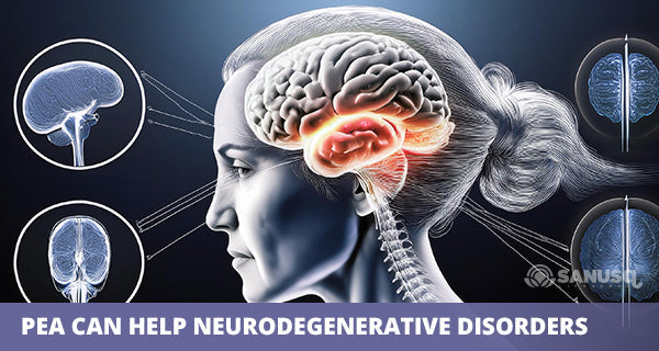 Palmitoylethanolamide (PEA) in Neurodegenerative Disorders